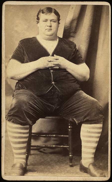 100 лет назад его показывали в цирке и он считался самым толстым человеком... Самый толстый человек на свете теперь наверно усмехнется над этим фото.
